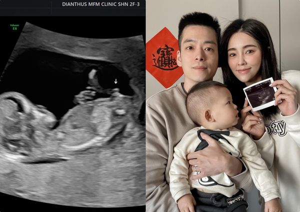 ▲陳郁安宣佈懷孕3個月喜訊，產檢超音波照片。（圖／凱渥提供）