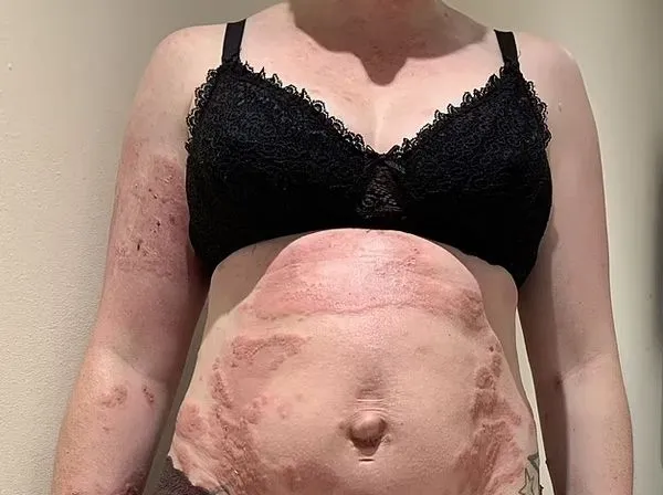 ▲▼Fiona Hooker。（圖／翻攝自每日郵報）