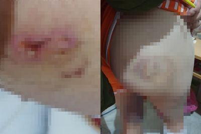 台北女送貨遭3犬咬傷!飼主丟1萬5喊和解:不就送貨的,薪水有多少