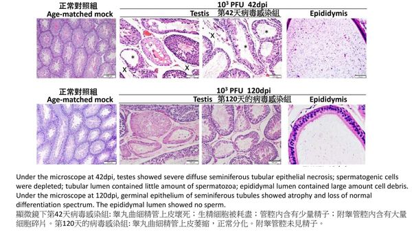 ▲▼倉鼠染新冠後「睪丸嚴重萎縮」　研究：男人生育能力可能受影響。（圖／翻攝香港大學）