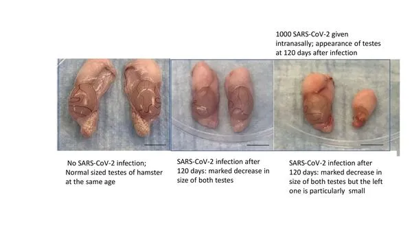 ▲▼倉鼠染新冠後「睪丸嚴重萎縮」　研究：男人生育能力可能受影響。（圖／翻攝香港大學）