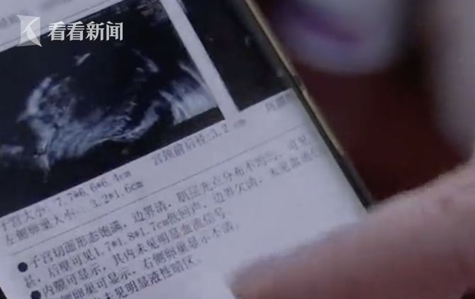 ▲▼ 女子體內取出“足球” 直徑27cm。（圖／看看新聞）