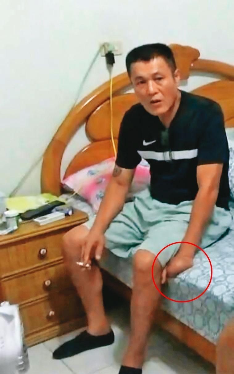 陳宏宗早年因工受傷，左手4指被截斷，只剩1根拇指（紅圈處）。（翻攝畫面）