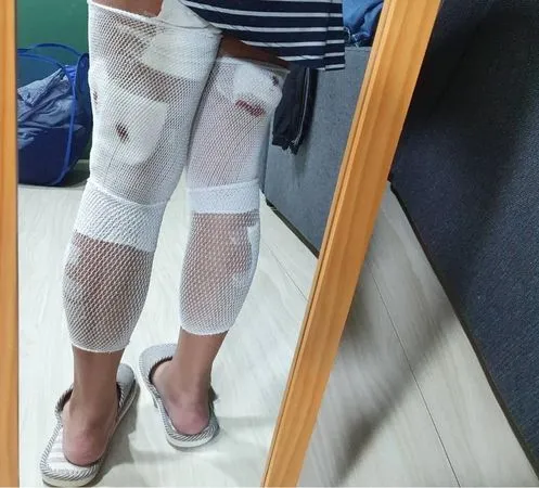 ▲網友PO文指台南永康科技園區有流浪狗群出沒傷人情事，提醒民眾活動時要小心。（圖／翻攝自臉書社群）