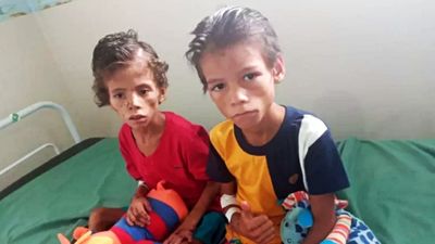 在亞馬遜雨林迷路27天！8歲小兄弟找漿果、喝雨水活下來　村裡大人心疼又佩服