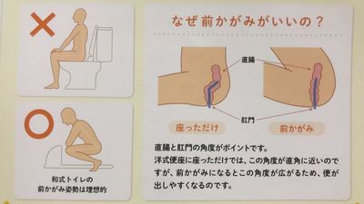 用坐式馬桶「腳上踏這個」大號超順暢　他驚呼：應該納進課綱