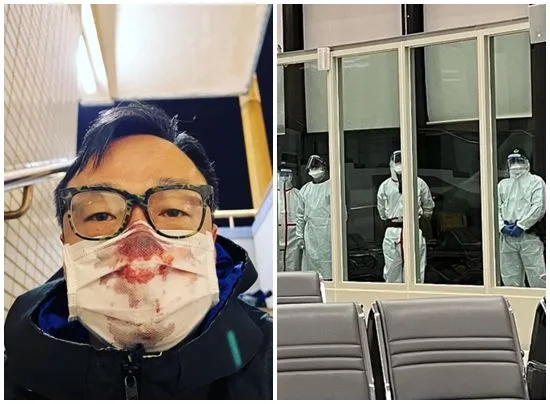 ▲替王喜止血的護理師是王樹偉醫師的好友。（圖／翻攝自王喜臉書）