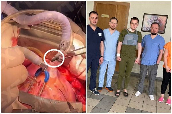 ▲▼外科醫師從烏克蘭士兵的心臟取出子彈。（圖／翻攝推特@SolNataMD、@HannaLiubakova）