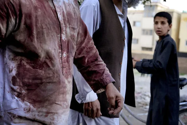 ▲▼阿富汗首都喀布爾（Kabul）哈利法薩西布清真寺（Khalifa Sahib Mosque）29日發生爆炸，造成至少50死。一名信徒衣服血跡斑斑。（圖／達志影像／美聯社）