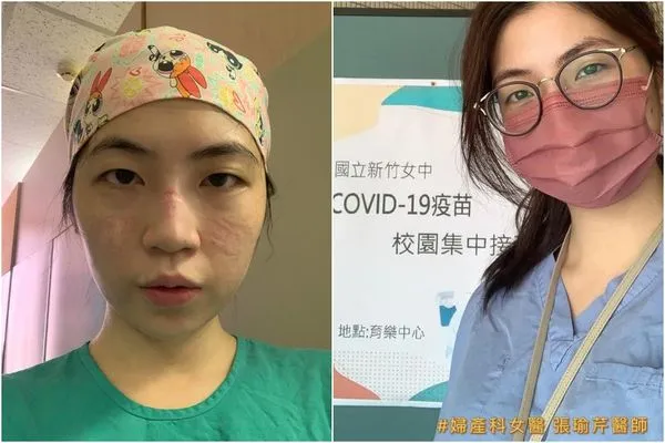 ▲▼醫院氣氛變了！美女醫警示「7大症狀」屬中重症　3種人恐快速惡化。（圖／翻攝張瑜芹臉書）