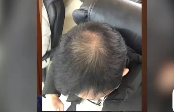 ▲▼ 禿頭男的進擊            。（圖／翻攝 浙報融媒體官方）