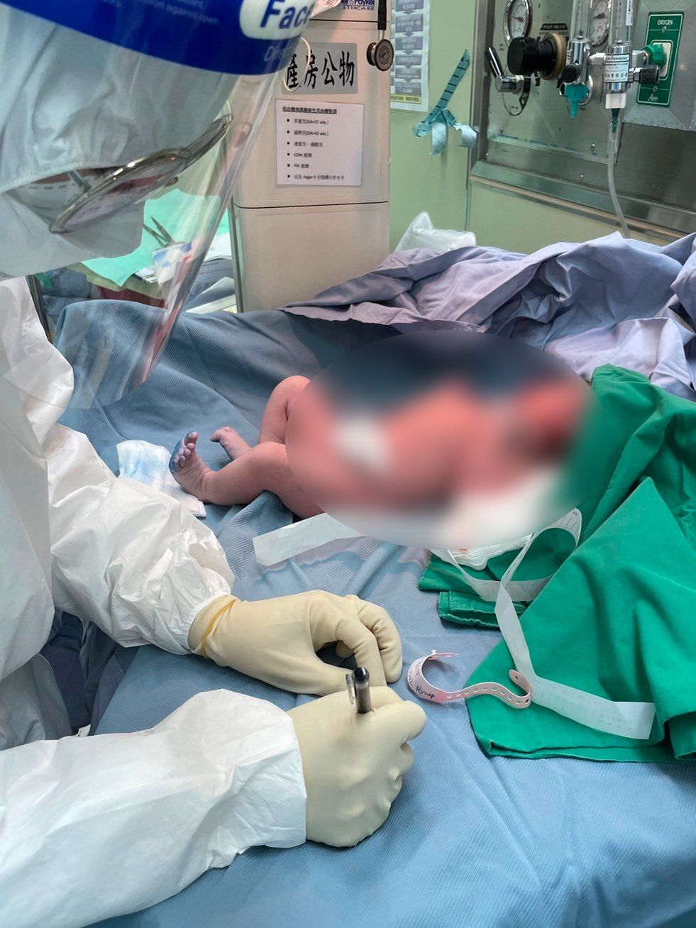 ▲▼北醫附醫團隊歷經1個多小時的手術，順利接生女嬰。（圖／北醫附醫提供）