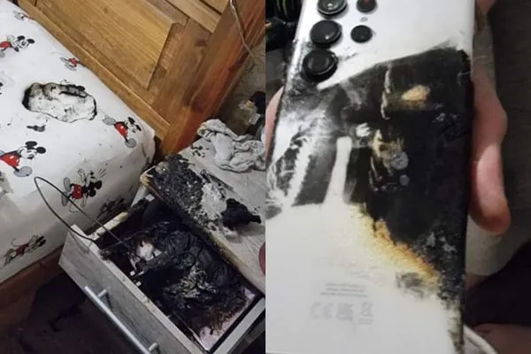 ▲▼手機半夜自燃　她「頭髮狂燒」嚇醒。（圖／翻攝自Facebook／Kyomi Edwina Kershaw）