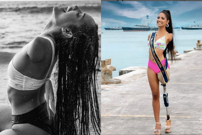 她觸電雙臂左腿截肢！20年後逆襲成火辣網紅　參加選美17萬粉力挺