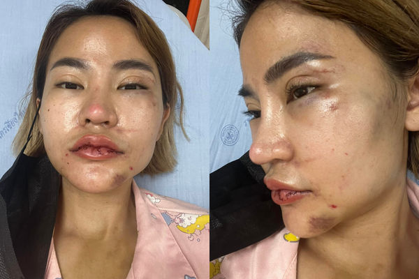 ▲▼泰國網美娃娃遭男友家暴毆打。（圖／翻攝自Facebook／วาวาไง กำลังพิมพ์）