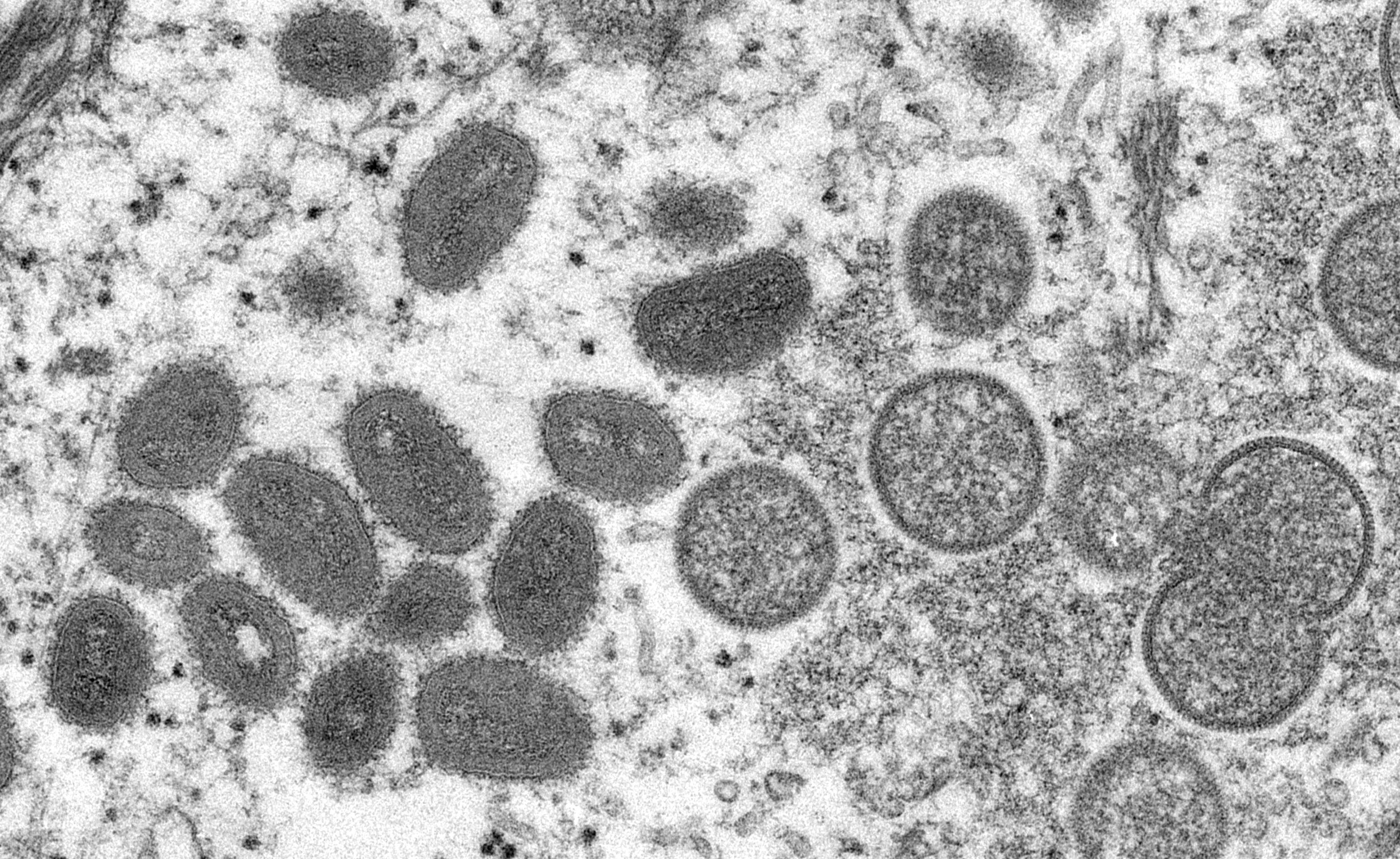 ღ▼ 電子顯微鏡影像顯示，左側為成熟橢圓形猴痘病毒顆粒，右側為新月型與球形顆粒的未成熟病毒粒子。（Picture /路透）