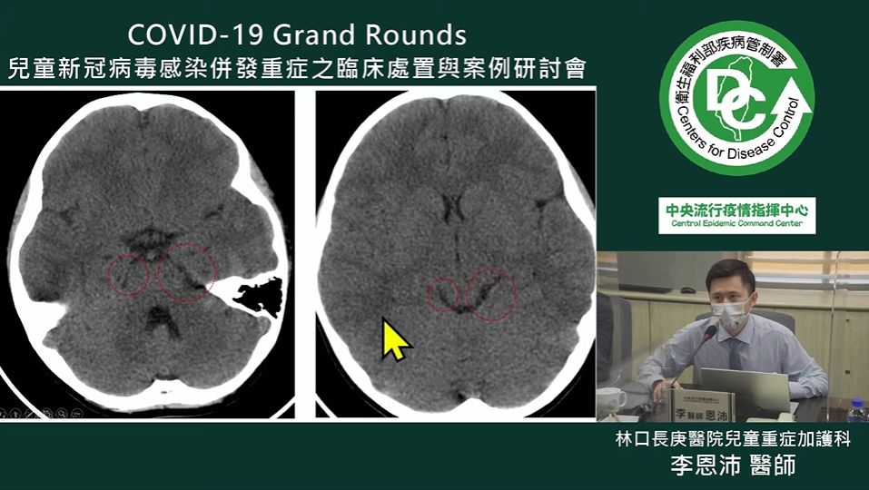 ▲▼林口長庚醫院兒童重症加護科主治醫師李恩沛。（圖／截自疾管署YouTube）