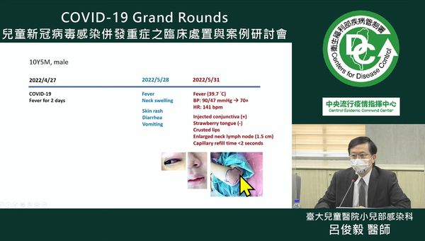 ▲▼6/11兒童新冠病毒感染併發重症之臨床處置與案例研討會，台大兒童醫院小兒部感染科醫師呂俊毅分享10歲童MIS-C個案。（圖／翻攝疾管署直播） 