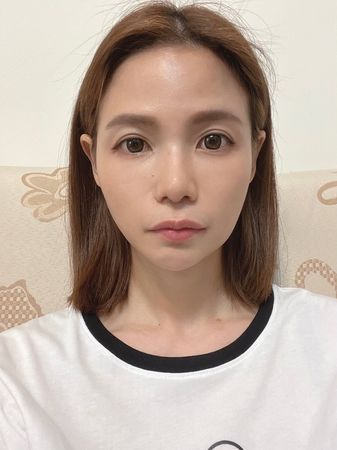 ▲蘿莉塔拔智齒。（圖／翻攝自Instagram／Lolita Lee 蘿莉塔）