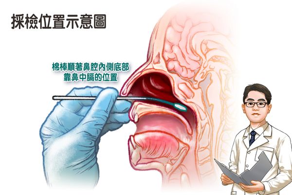 ▲▼台中慈濟感染科醫師表示，快篩試驗如果在15分鐘內出現T線才準，太久就沒意義了。（圖／慈濟醫院提供，下同）