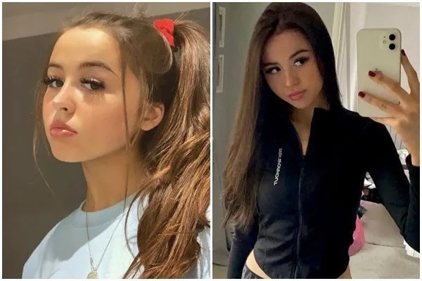 ▲▼英國20歲少女安妮（Annie Marshall）怪病纏身（圖／翻攝ig@annierosemarshall）