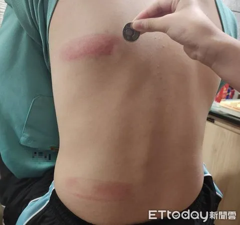 ▲▼「愛心老師」持曲棍球打傷學生。（圖／家長提供）