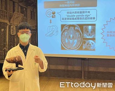 女大生突發憂鬱症與學習障礙　醫師：得這種病是3萬分之1