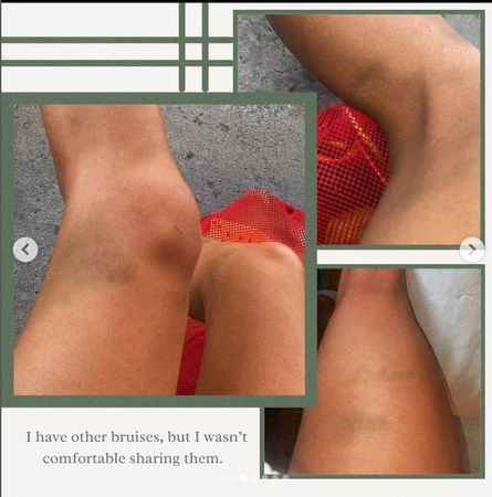 ▲▼加拿大22歲游泳明星哈維驚傳遭下藥，醒來全身傷             。（圖／翻攝自IG／marysophieharvey）