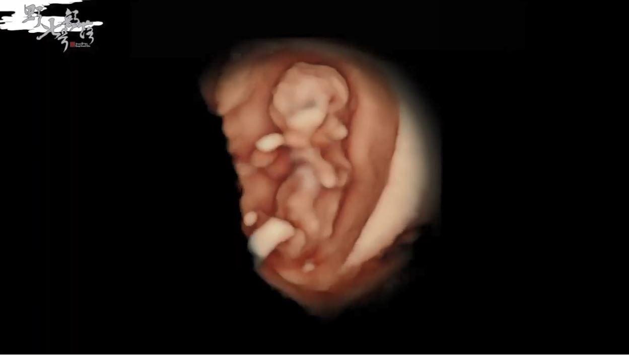 ▲KID公開寶寶超音波畫面。（圖／翻攝自YouTube／野人七號部落）