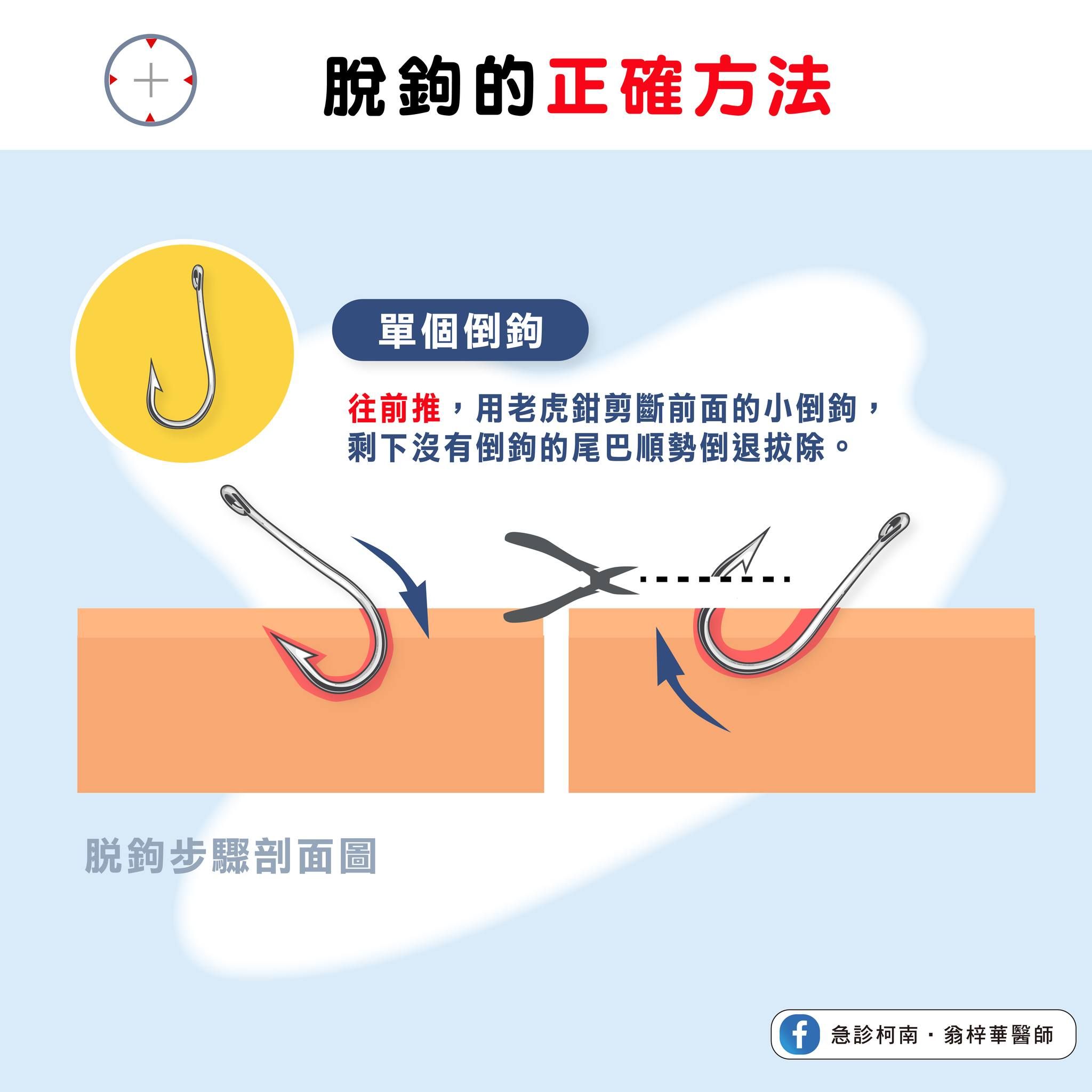 ▲被魚鉤勾到千萬別亂拔。（圖／翁梓華授權提供）