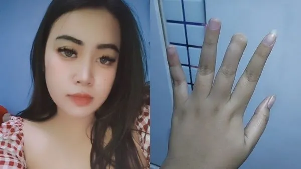 ▲▼女子透露，父母當時忘了拔嬰兒手套，才導致中指指頭壞死截肢。（圖／翻攝自TikTok@wulandira9）