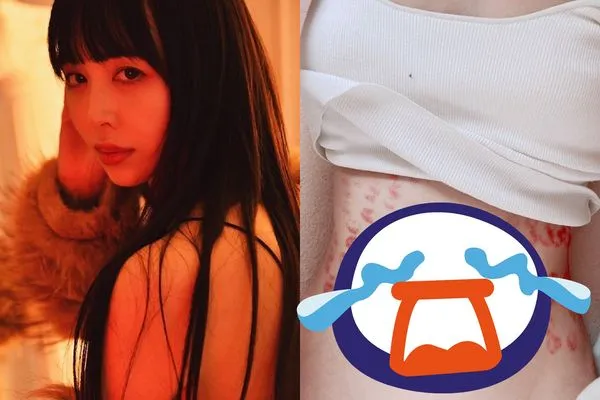 ▲日本AV女優寶生莉莉痛訴做除毛手術慘遭燒燙傷。（圖／攝自宝生リリー推特、ＩＧ）