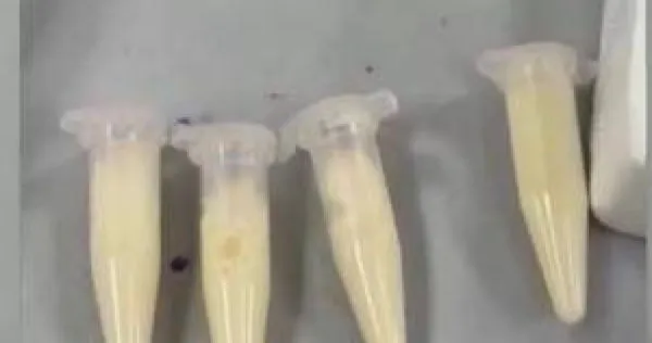 孕婦每天1杯奶茶喝出「奶茶血」。（圖／翻攝自微博）