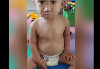 2歲童呼吸困難「胸肋骨全凹陷」！影片曝光　醫示警：3徵兆危險了