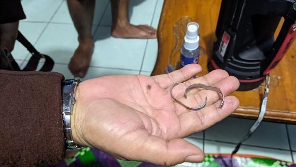▲▼印尼一名男子將戒指卡在生殖器上無法取消，最後不得不尷尬地向消防局求助。（圖／翻攝自推特）