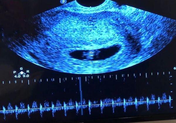 ▲▼海芬做產檢驚見「胎兒比正常小1週」　被醫生特別叮嚀。（圖／翻攝自Facebook／海芬的大明星小跟班）