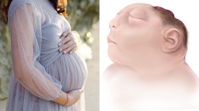 美國女懷孕10週發現「胎兒沒顱骨」　醫受限墮胎禁令：必須懷著孩子直到他死