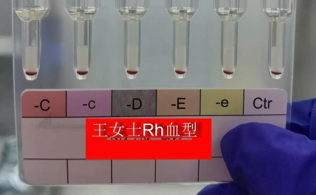 ▲▼江蘇出現罕見黃金血型。（圖／翻攝自新京報）