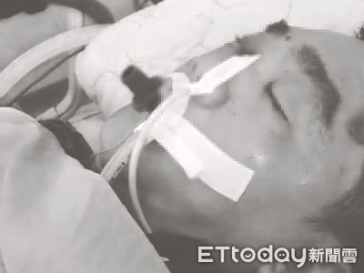 遭「景山」槽車追撞！司機裝葉克膜搶命　害死2警黑歷史再被挖出