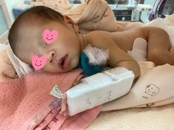 ▲▼1名未足月的女嬰左大腿骨折，家長心疼怒指院方虐待，烏日林新表示，檢調已在調查。（圖／爆料公社提供，下同）