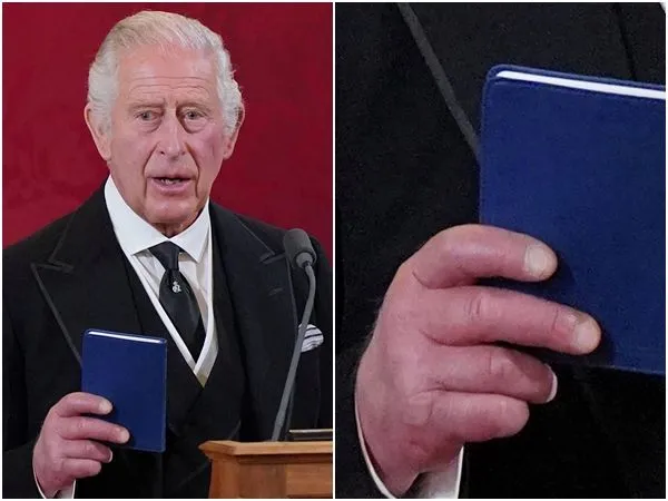 ▲▼查爾斯三世10日宣誓繼位成為英國新君主，然而，他紅腫的手指照片卻在網路上瘋傳，意外成為網友關注焦點。（組圖／路透）