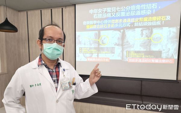 痛到歪腰又泌尿道感染　驚見7公分鹿角性結石 | ETtoday健康雲 |