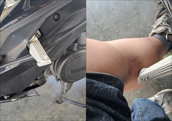 ▲▼機車族超怕「脛骨擊碎器」 他曬瘀青照引共鳴：痛到秒噴髒話。（圖／翻攝自爆廢公社公開版）