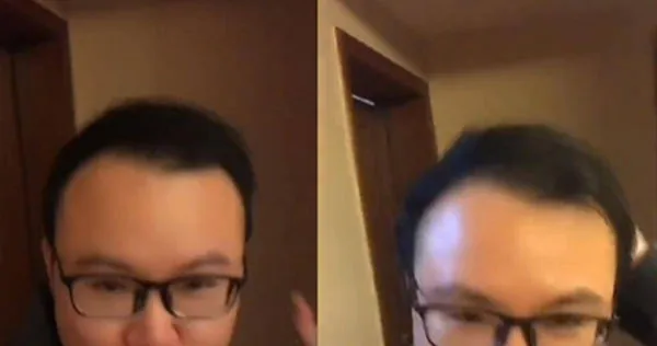 半年不用洗髮精，他從「禿頂變滿頭黑髮」驚人影片曝。（圖／翻攝自微博）