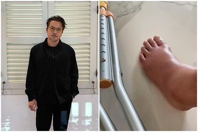 金鐘倒數3天…視帝爆「不能來了」！誇張腳傷照曝：到底是豬還是人
