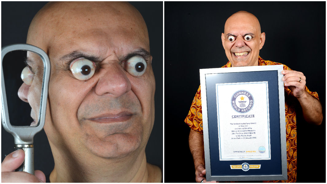 ▲▼巴西男子梅斯奎塔（Sidney de Carvalho Mesquita）是世界上眼睛最凸的男人。（圖／翻攝金氏世界紀錄官網）