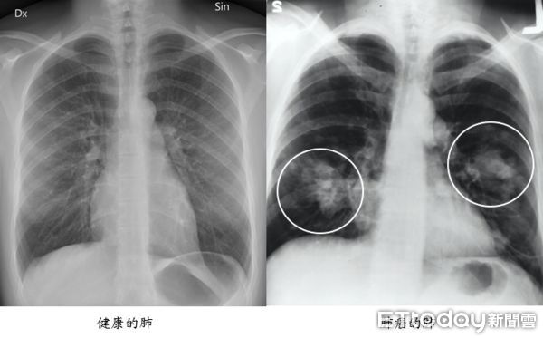 ▲▼宣示打造「無菸醫院」！　北榮院長陳威明：院區內全面禁菸。（圖／台北榮總提供）