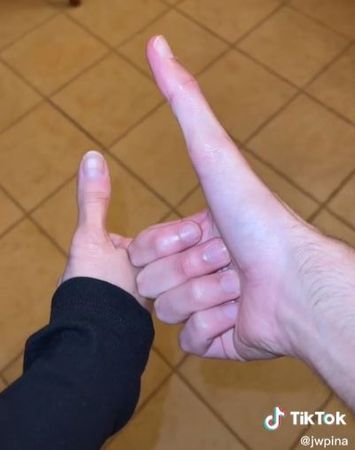 [問卦] 超長的大拇指有什麼用途？