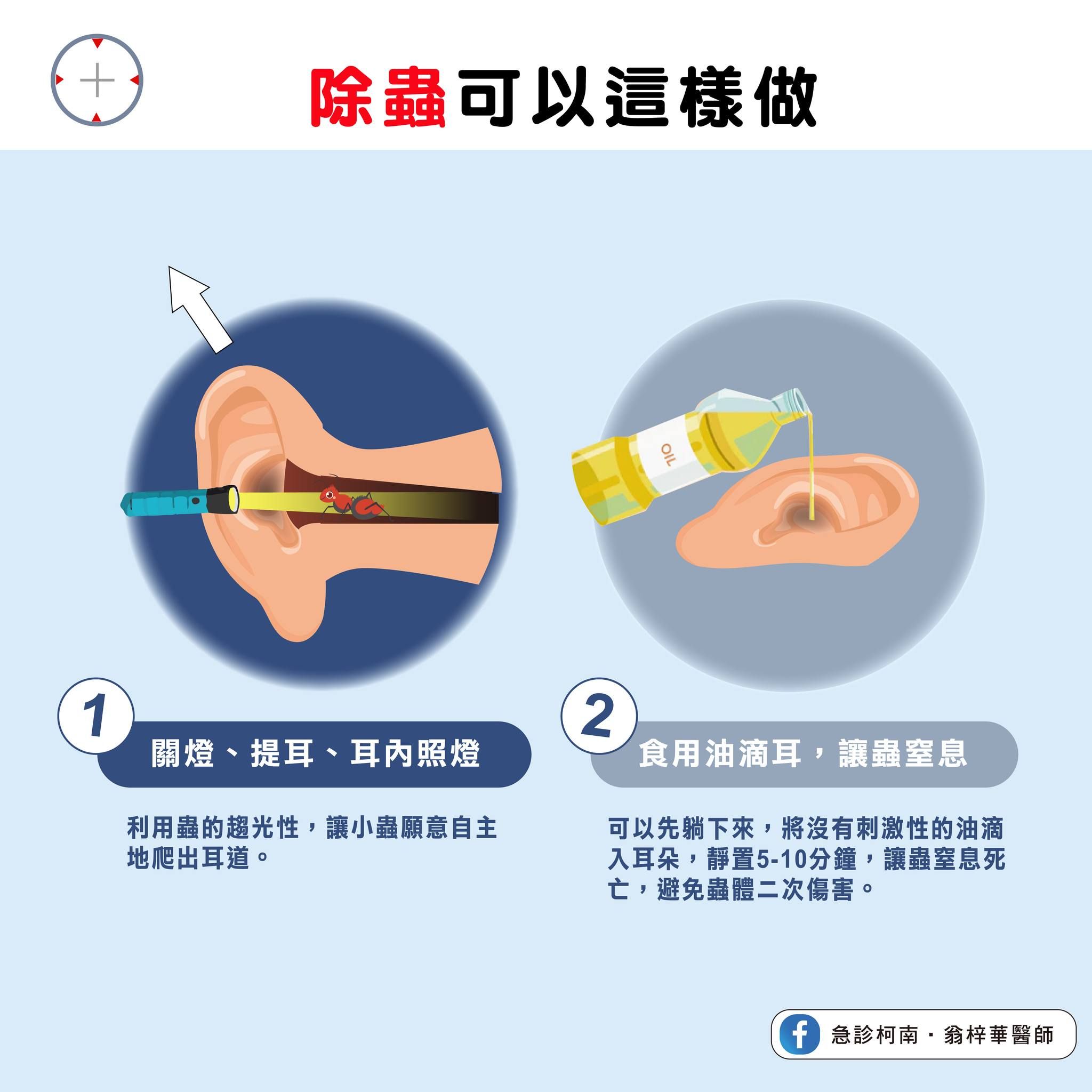 ▲蟲蟲跑到耳朵的處理方式。（圖／翁梓華醫師授權提供）