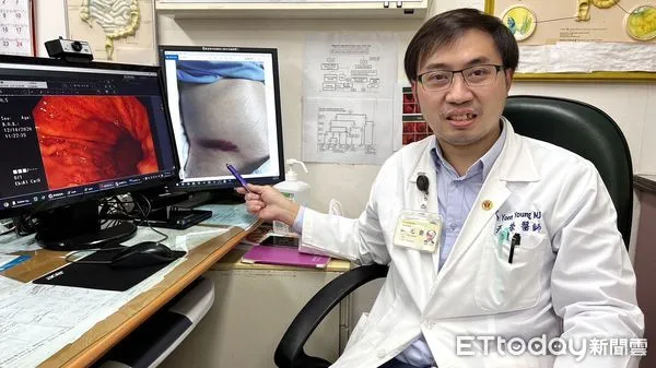 ▲屏基胃腸肝膽科主治醫師蔡元榮             。（圖／屏基提供，下同）